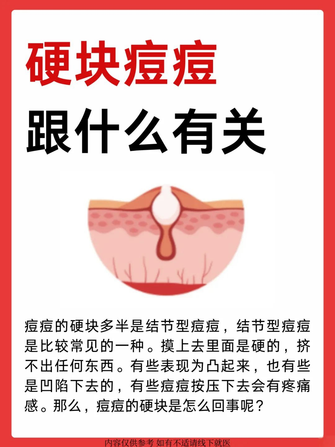 额头长痘痘什么原因(儿童额头长痘痘什么原因)