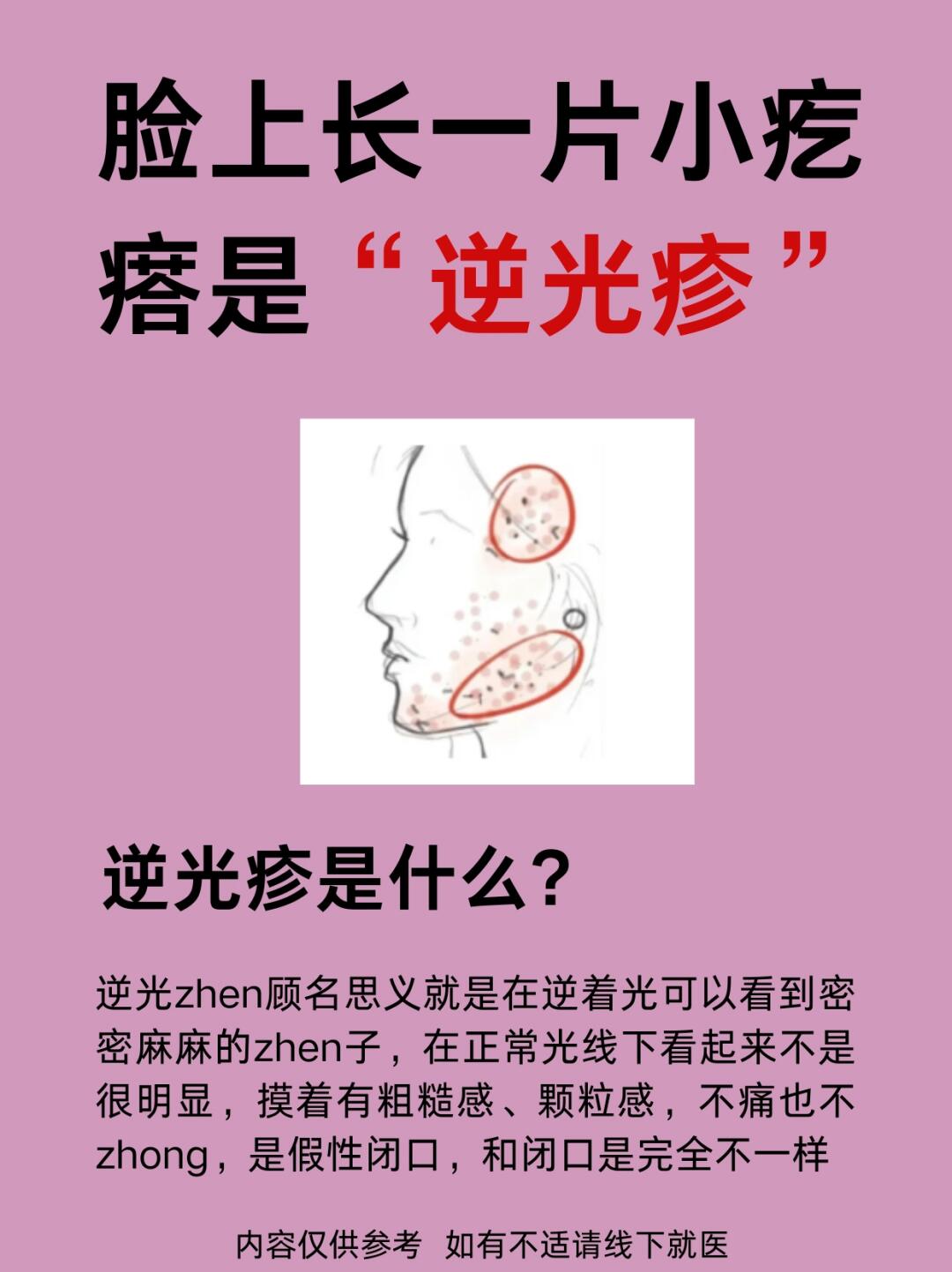 太阳穴长痘痘是什么原因(太阳两侧长痘痘是什么原因是什么)