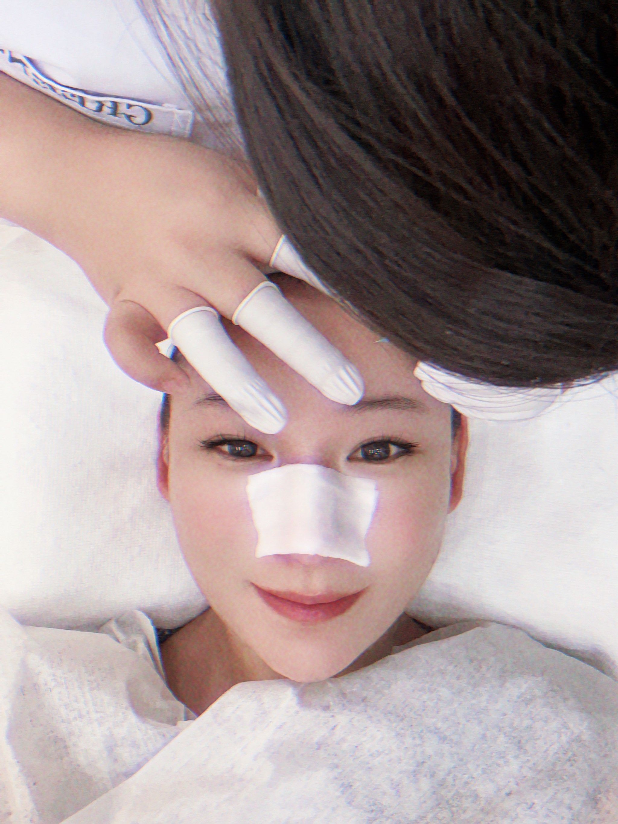 痘痘治疗(痘痘治疗药物)