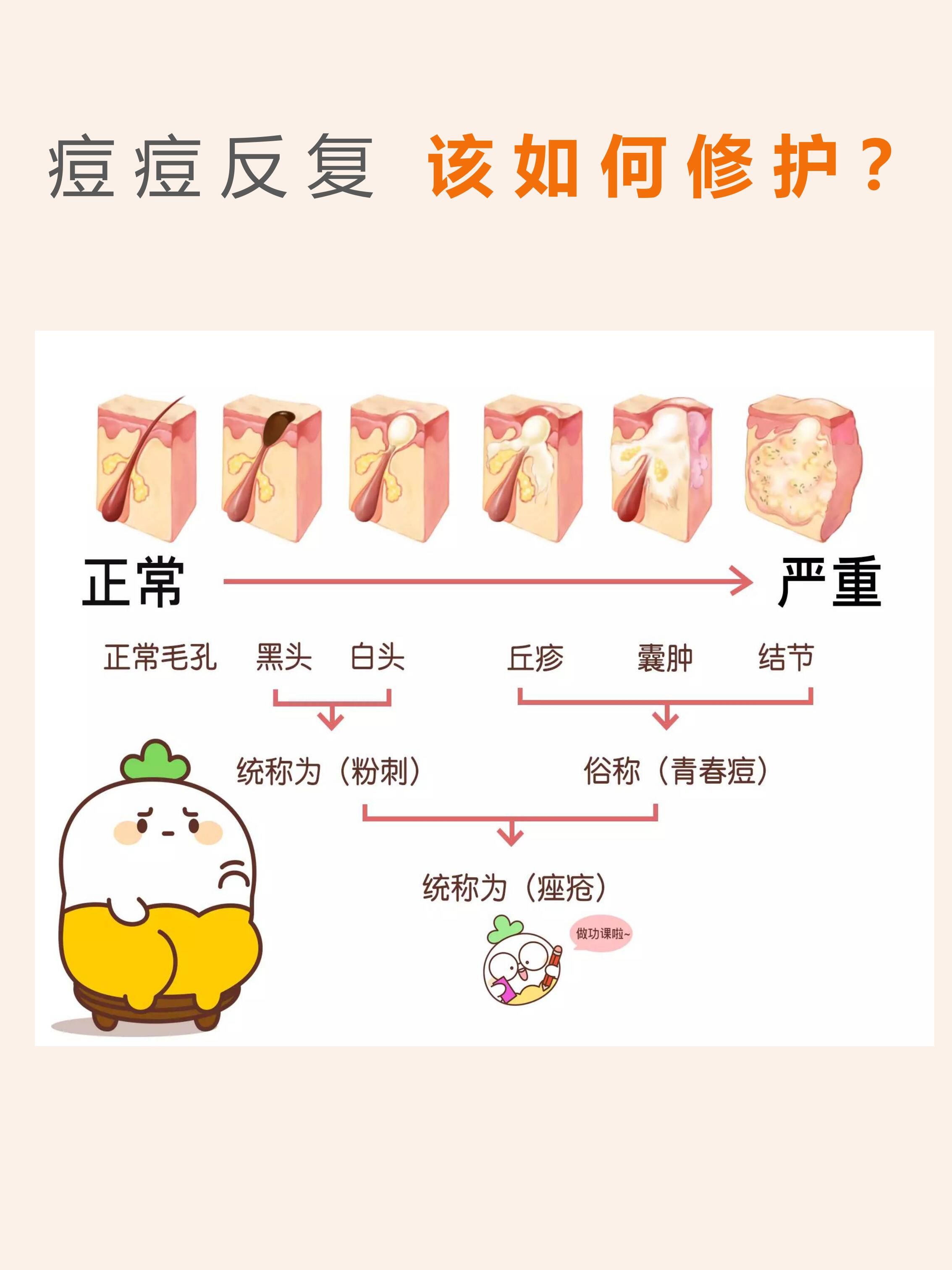 脸上长痘痘咋办(脸上长了好多痘痘怎么办)