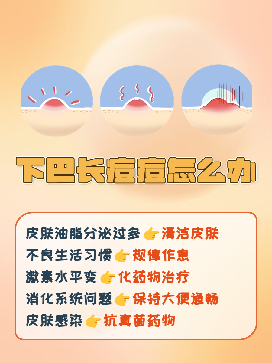 长痘痘的解决方法(前胸后背长痘痘的解决方法)