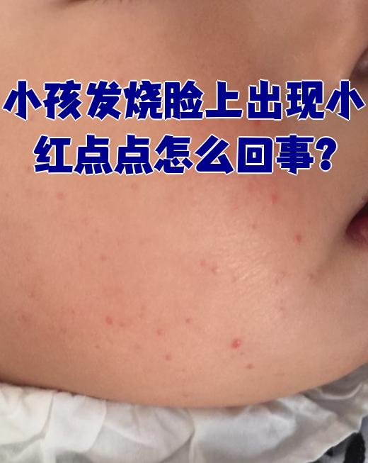 脸上有红点又不像痘痘(湿气重的小红点图片)