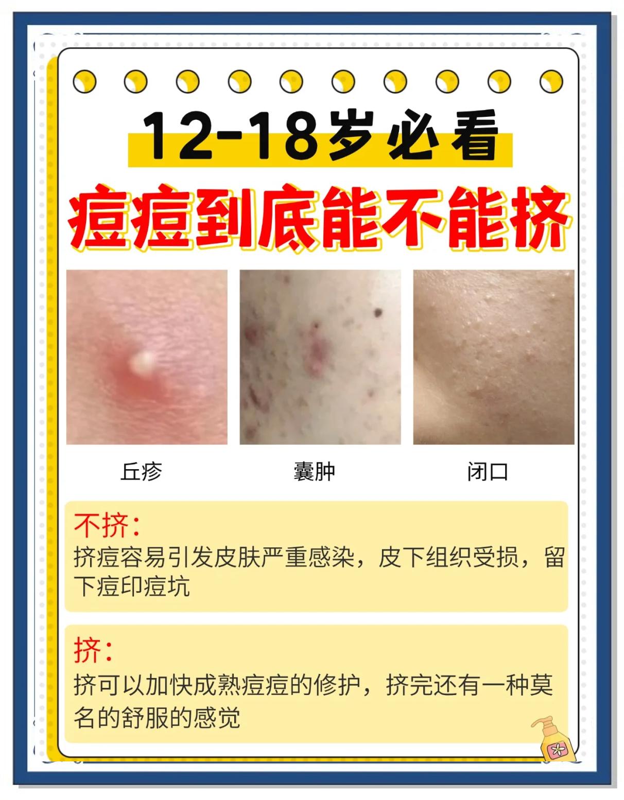 祛除痘痘的有效方法(老年斑消除最好的方法)