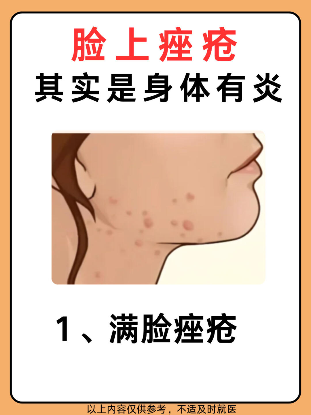 熬夜会长痘痘吗(熬夜会长痘痘吗?女生)