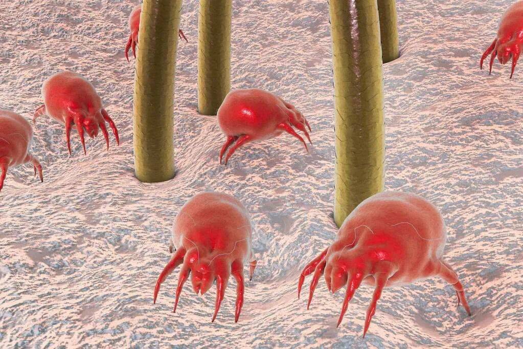 痘痘挤出来的白色东西是什么(身上出现痘痘能挤出白点)