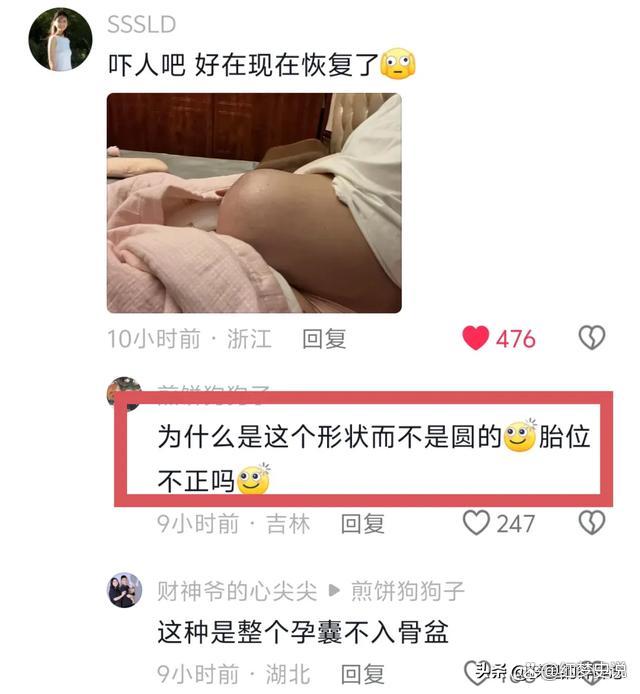 怀孕会长痘痘吗(怀孕会长痘痘吗下巴)