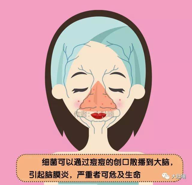 三角区长痘痘是什么原因(女性三角区长痘痘是什么原因)