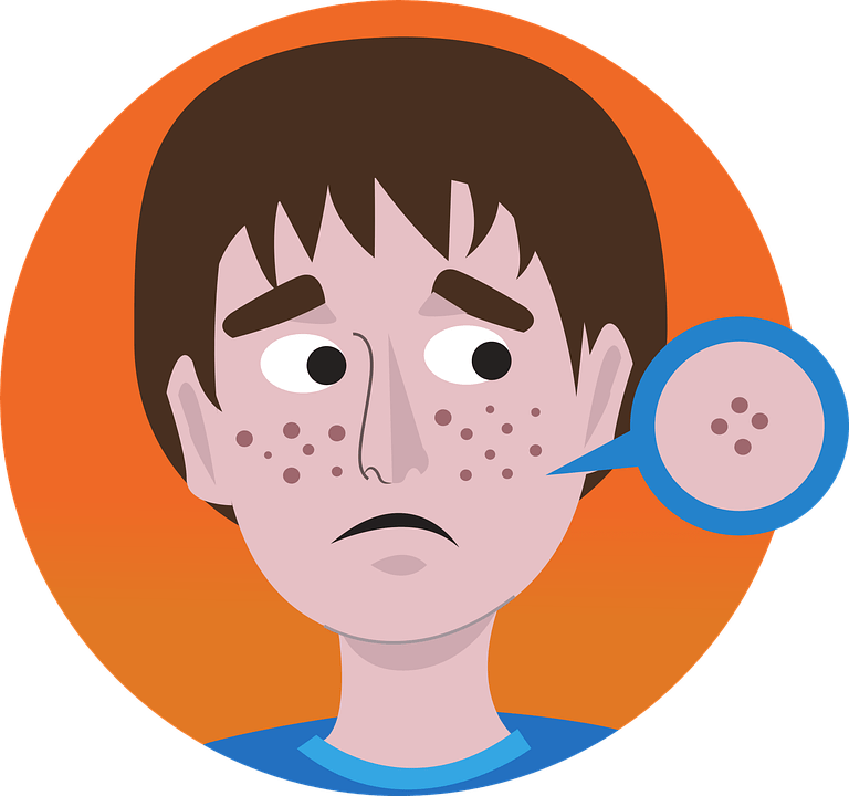 三角区长痘痘是什么原因(女性三角区长痘痘是什么原因)