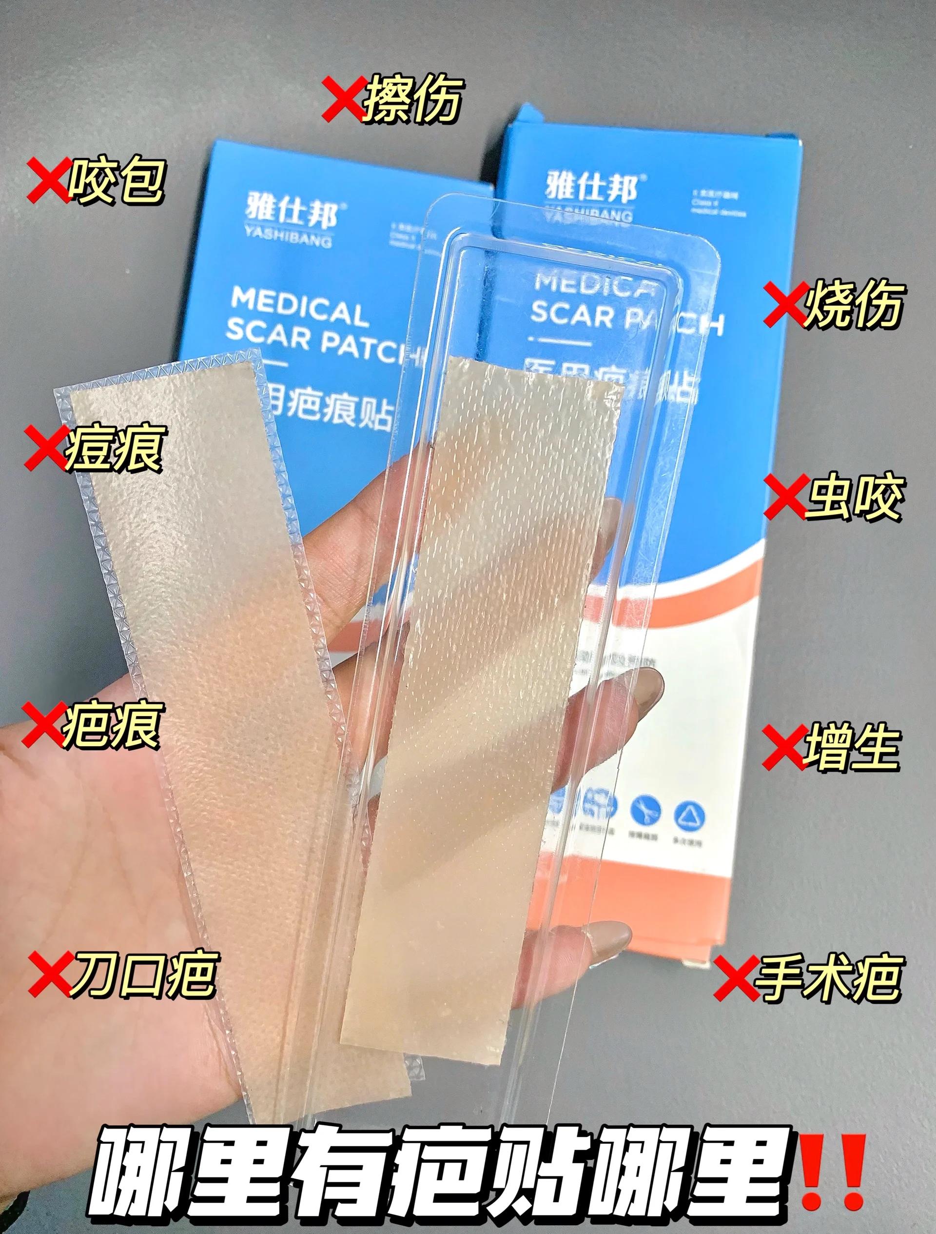 痘痘贴有用吗(壬二酸痘痘贴有用吗)