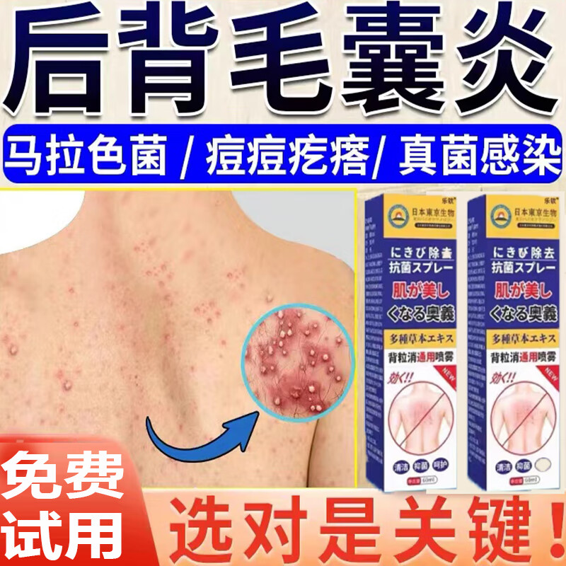 背上长痘痘怎么办(吃避孕药背上长痘痘怎么办)