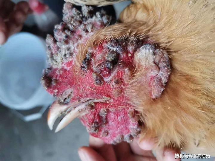 鸡儿上面长了痘痘(鸡儿上面长了痘痘良性的怎么消除)