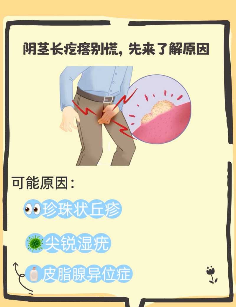 鸡儿上面长了痘痘(鸡儿上面长了痘痘良性的怎么消除)