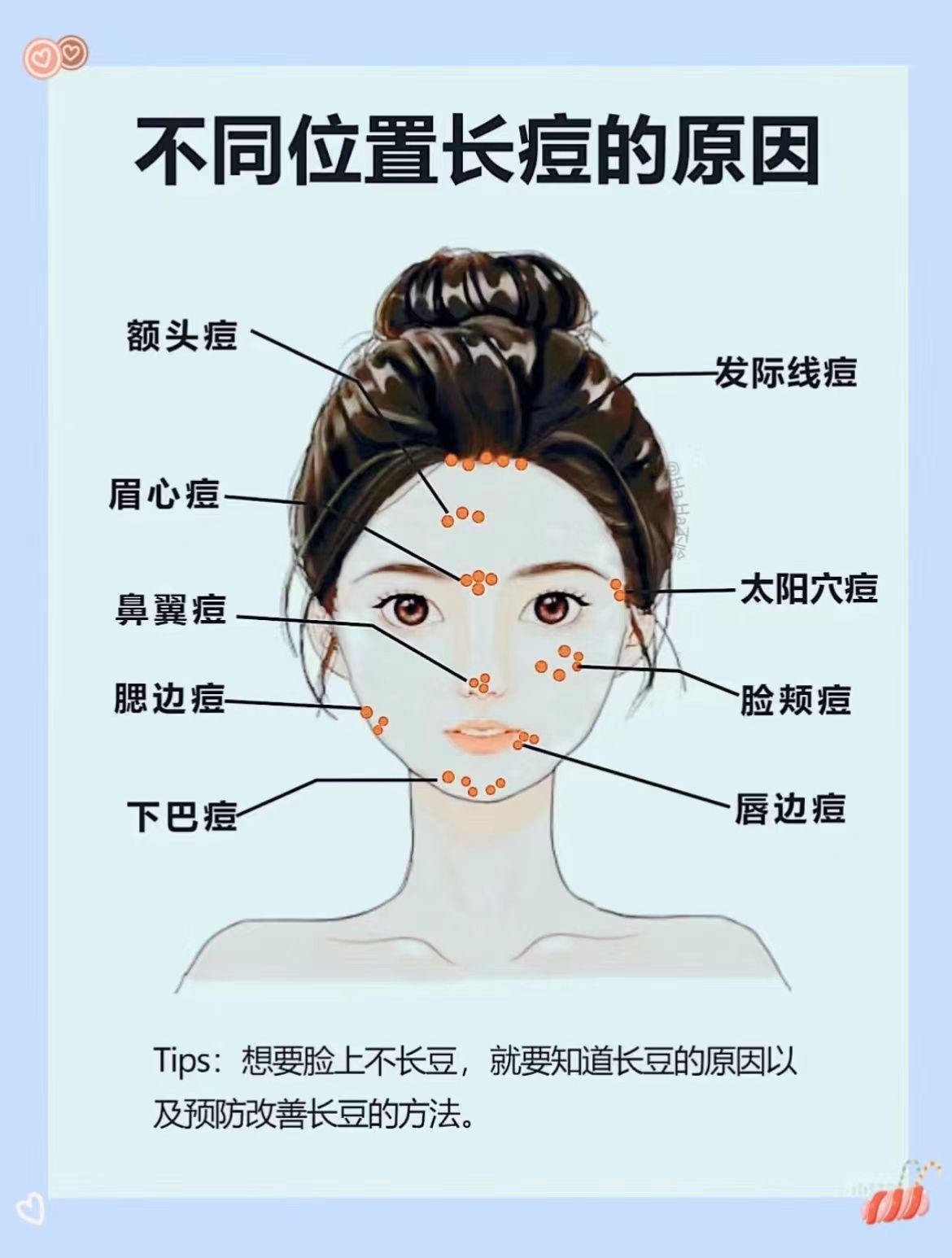 脸上经常长痘痘是什么原因(女孩子脸上经常长痘痘是什么原因)