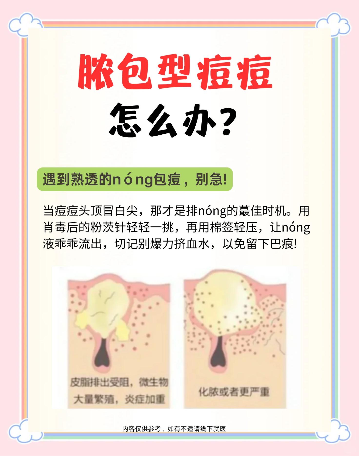 脸上有痘痘怎么办(脸上有痘痘怎么办用盐)