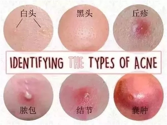 包含外阴长痘痘的词条