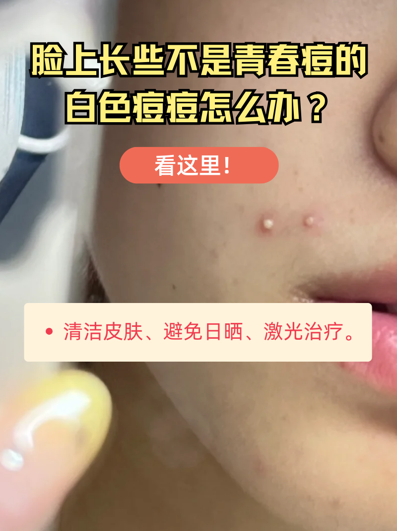 脸上长痘痘怎么办(熬夜脸上长痘痘怎么办)