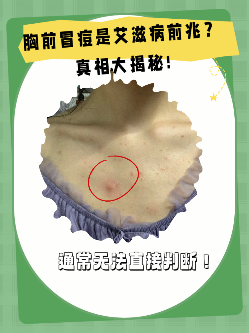 胸前长痘痘怎么回事(男的胸前长痘痘怎么回事)