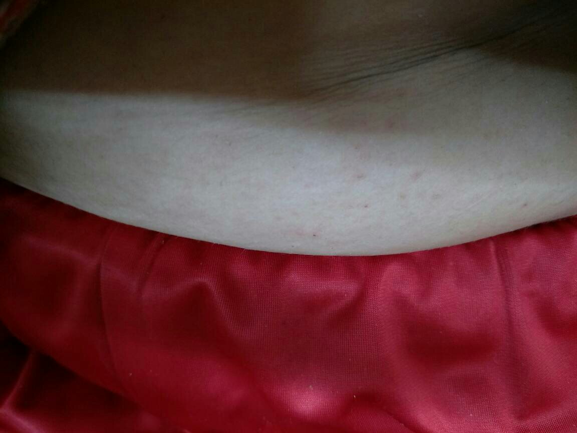 胸口长红色的小痘痘(胸口长红色的小痘痘用什么涂)