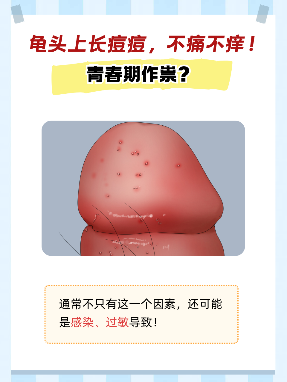 男生下面长了痘痘图片(男生下体长了颗痘是什么原因)