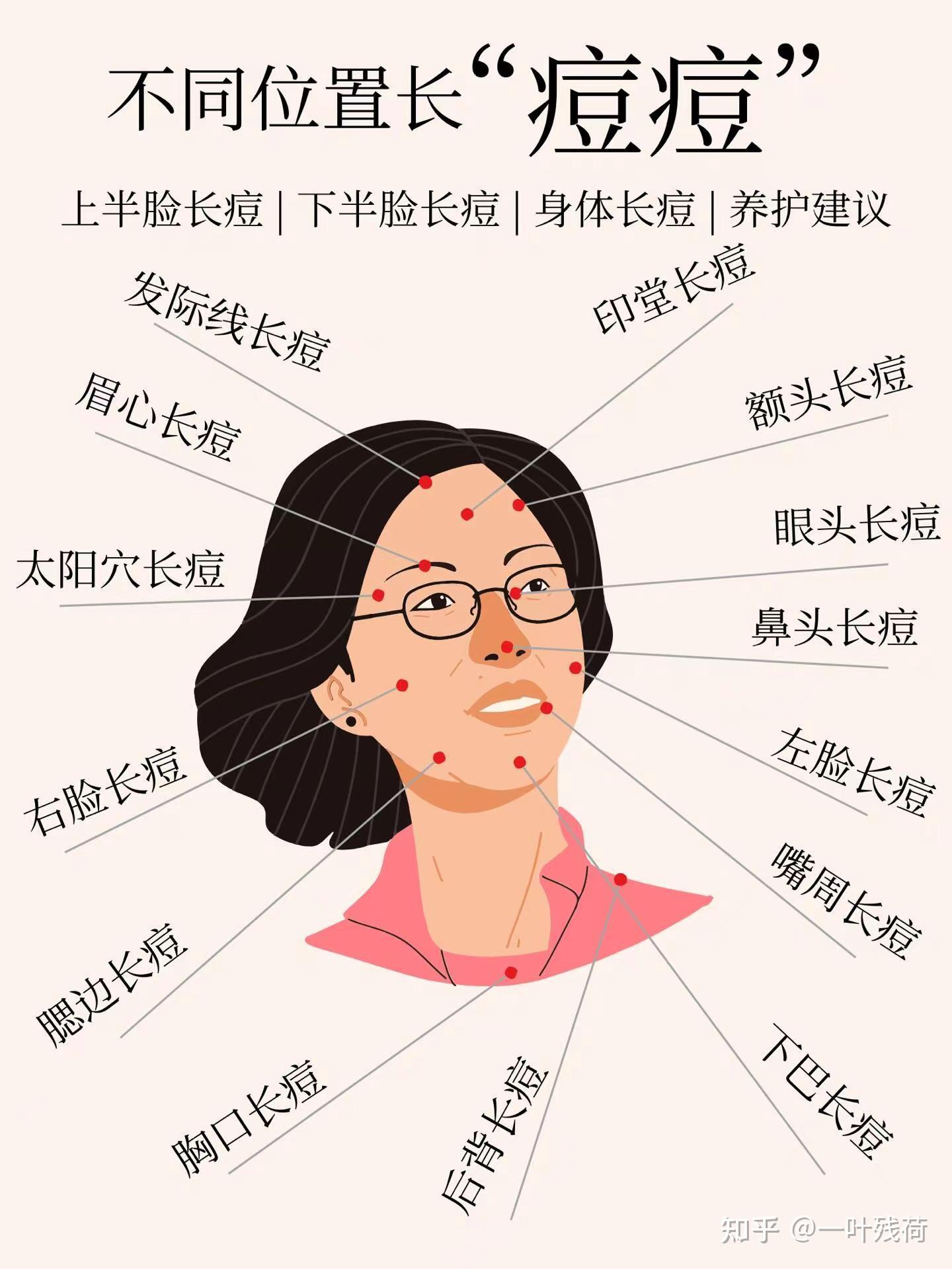 头上长痘痘怎么办(初中生头上长痘痘怎么办)