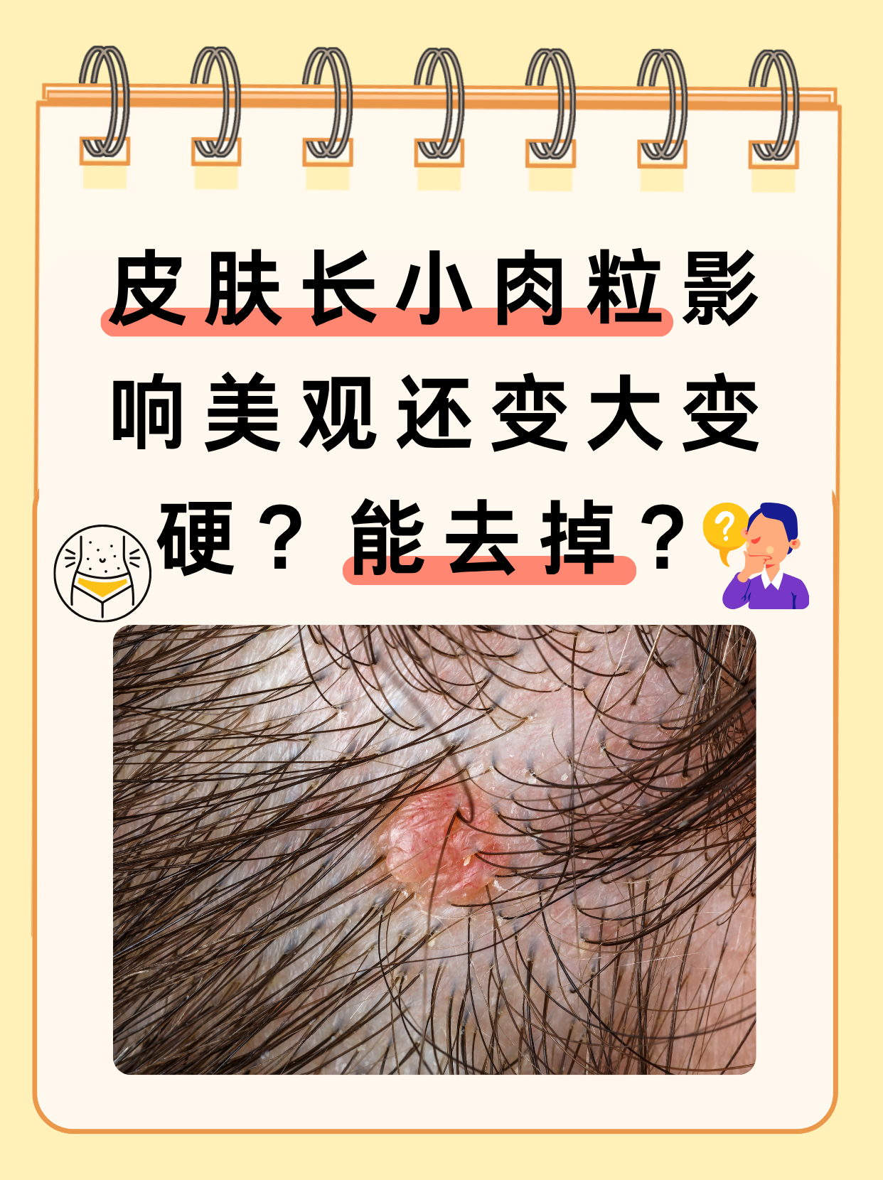 头发里面长痘痘是怎么回事(头发里面长痘痘是怎么回事一碰特疼)