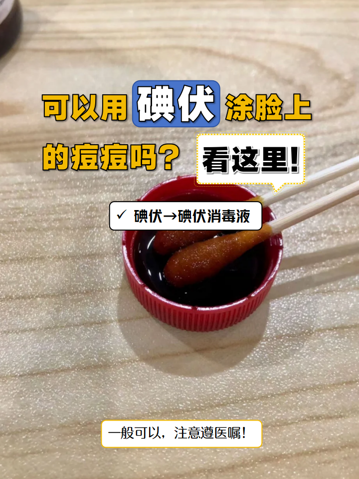 碘伏可以擦脸上痘痘吗(面部痤疮最佳治疗方法)