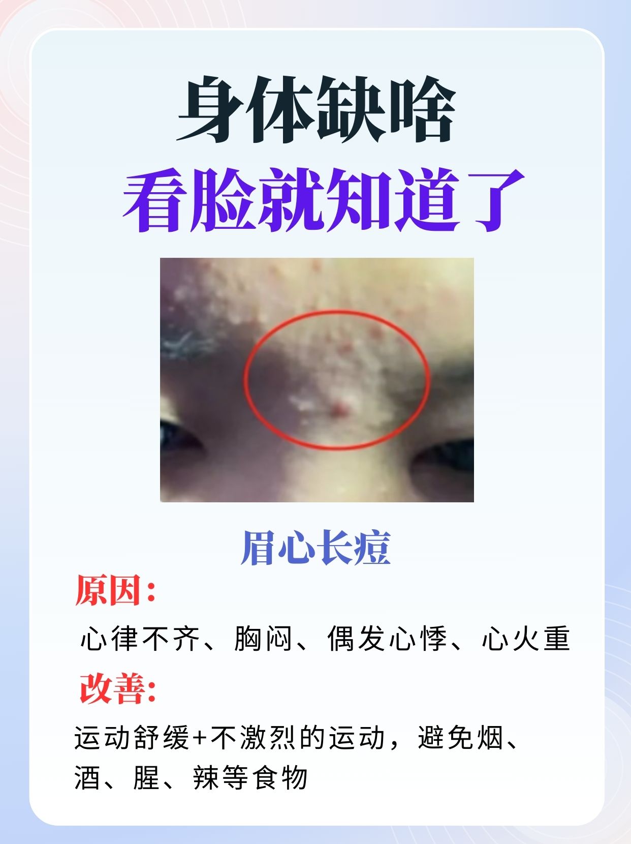 唇周围长痘痘是什么原因(男生唇周围长痘痘是什么原因)