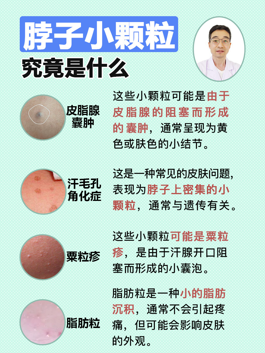 脖子上长痘痘是什么原因(后背脖子上长痘痘是什么原因)