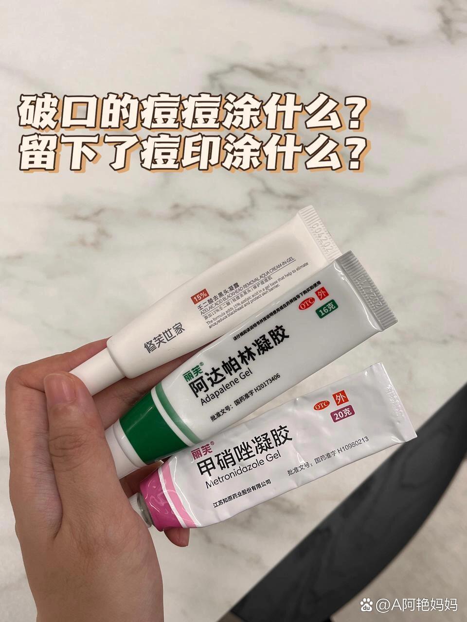 甲硝唑凝胶能去痘痘吗(去痘痘买什么药膏)