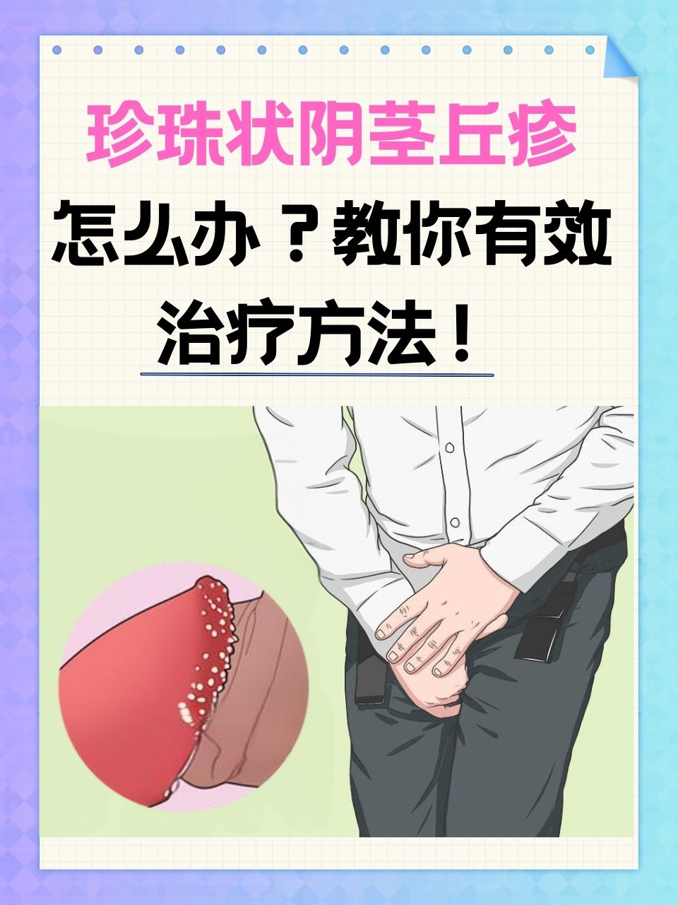 阴茎上长痘痘(小弟皮上面长痘痘是什么情况)