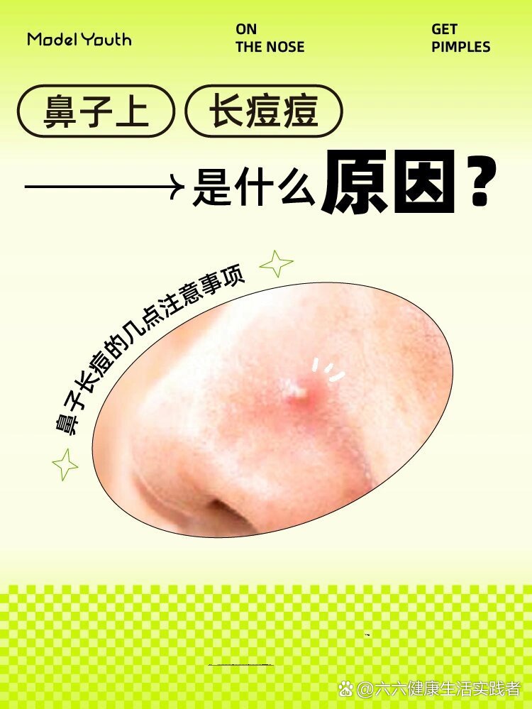 鼻子上长痘痘是怎么回事(鼻子老长痘痘是怎么回事)
