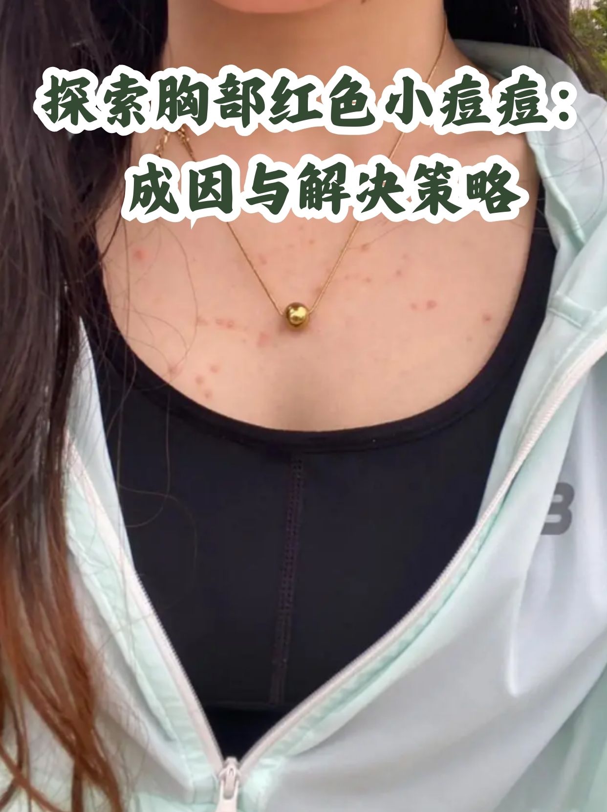 胸口长痘痘是什么原因(男人胸口长痘痘是什么原因)