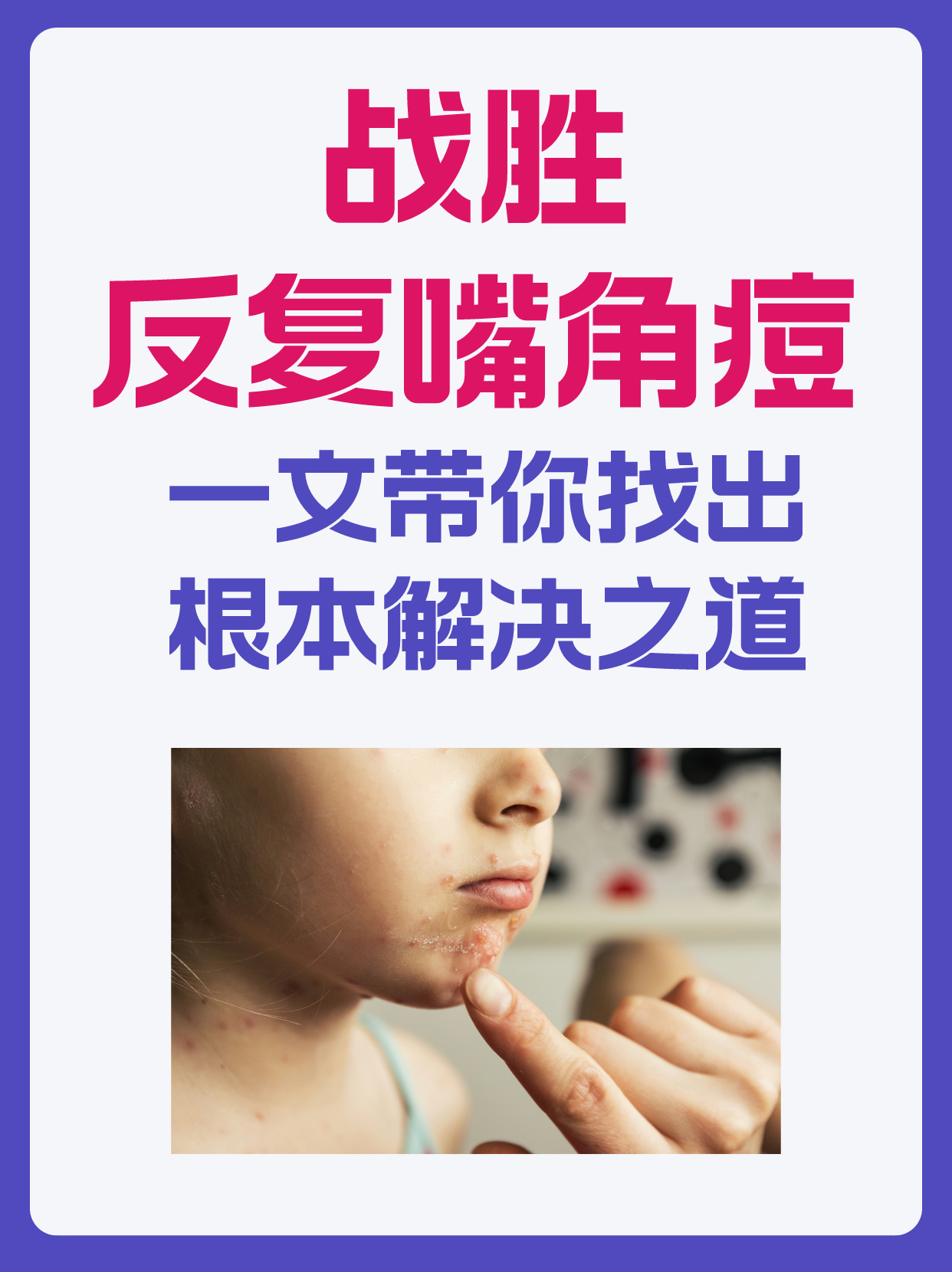 嘴边长痘痘是什么原因(嘴边长痘痘是什么原因造成的起泡怎么快速消除)