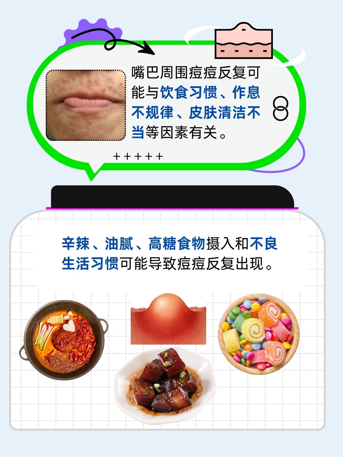 嘴巴周围长痘痘是怎么回事(嘴巴周围长痘痘吃什么药效果好)