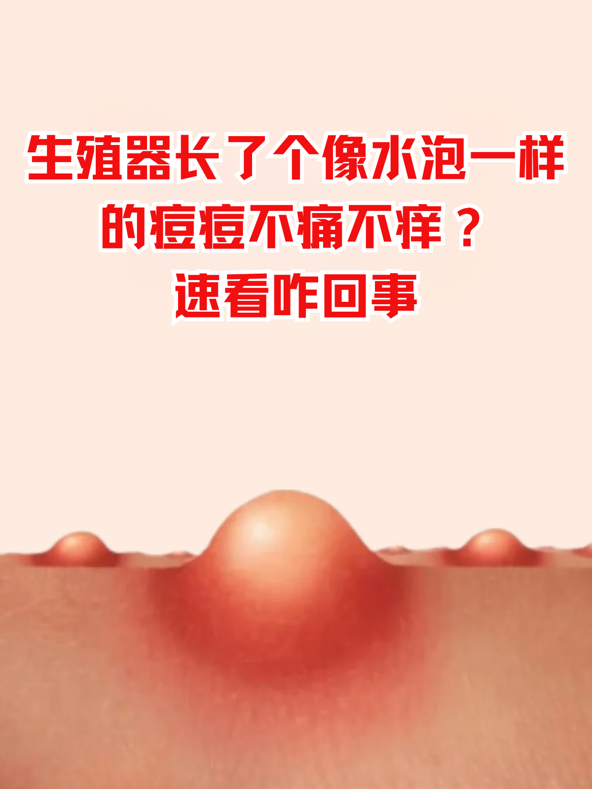 阴茎上长痘痘图片(hpv长痘痘图片)