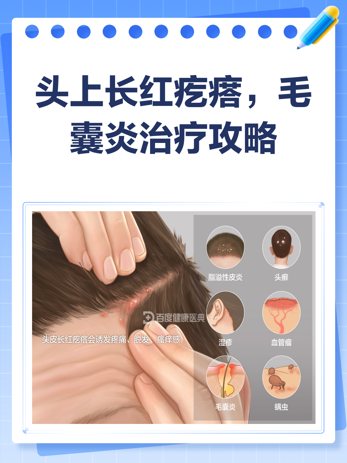 头上长痘痘怎么治疗(头上长痘痘怎么根治)