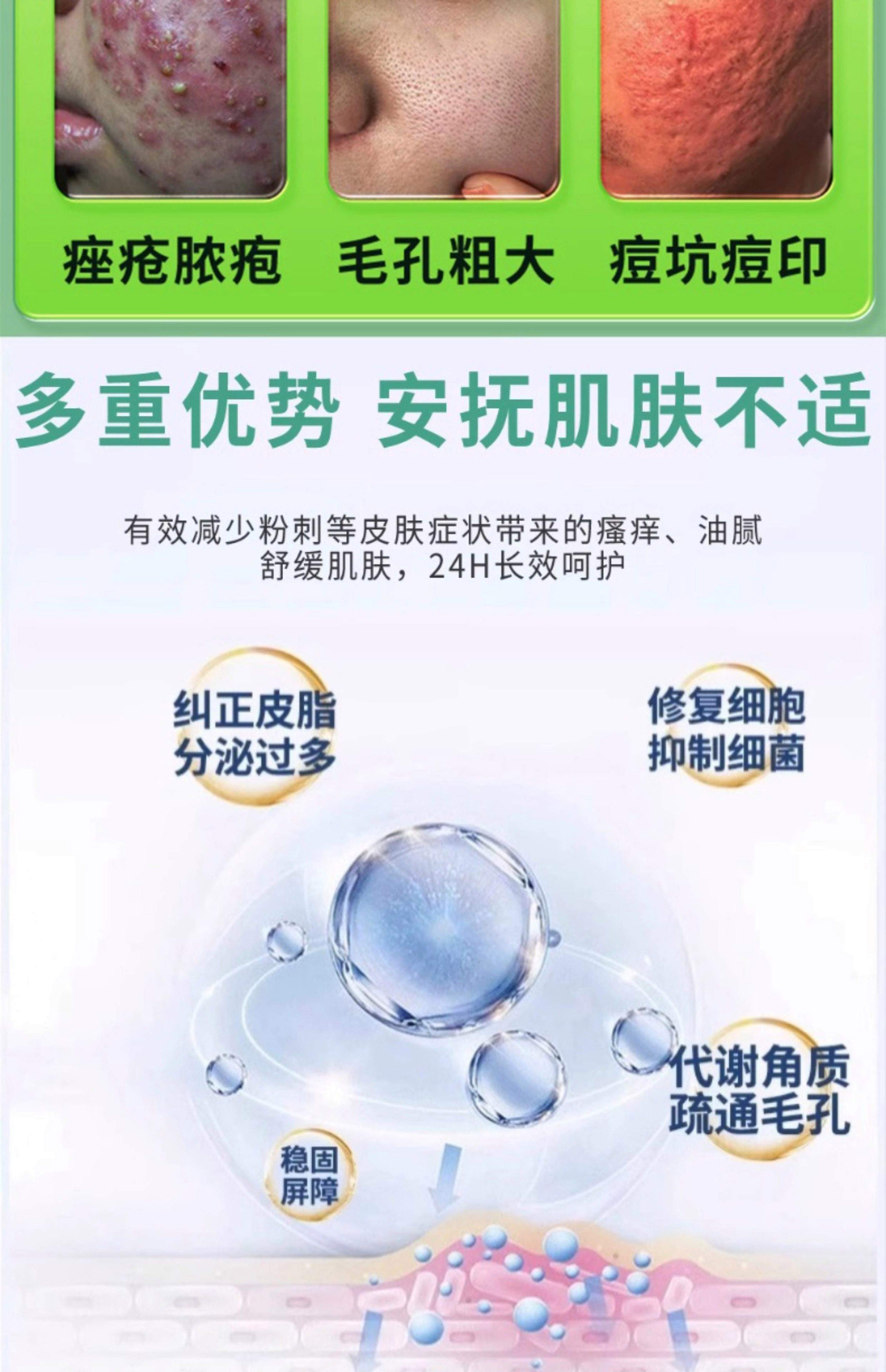 下巴长痘痘怎么治好(下巴长痘是胃火还是肝火)