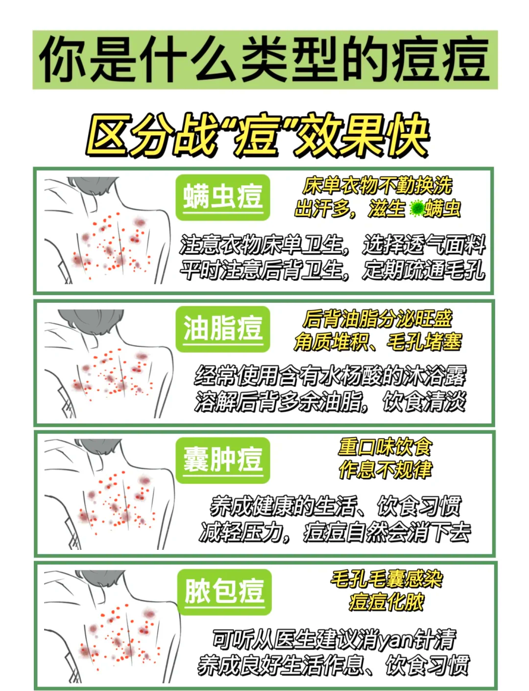 身上长痘痘怎么回事(女生身上长痘痘怎么回事)